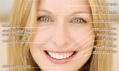 DermaFillerPlacement